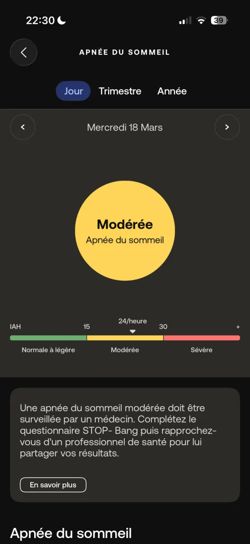 apnée du sommeil sleep analyzer