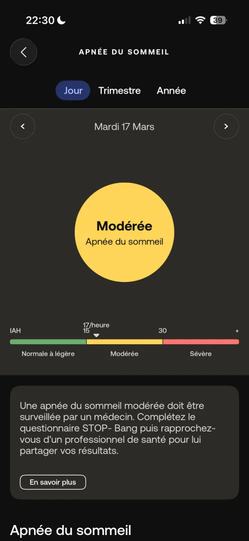 apnée du sommeil sleep analyzer