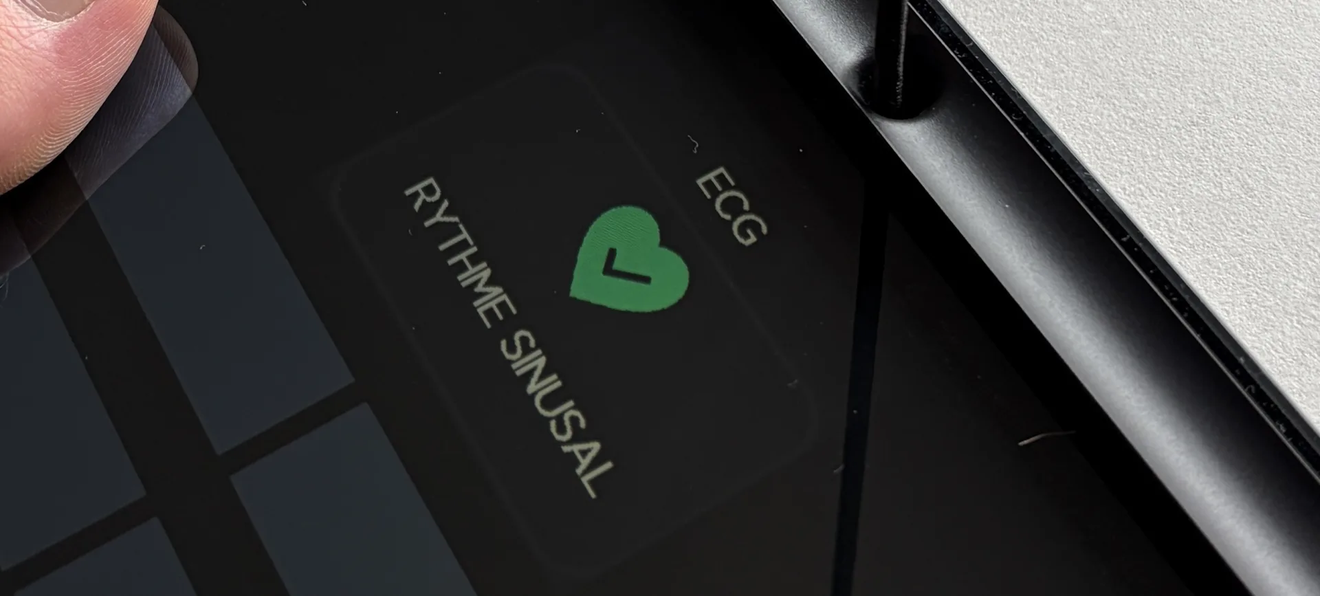 Résultat ECG : rythme sinusal