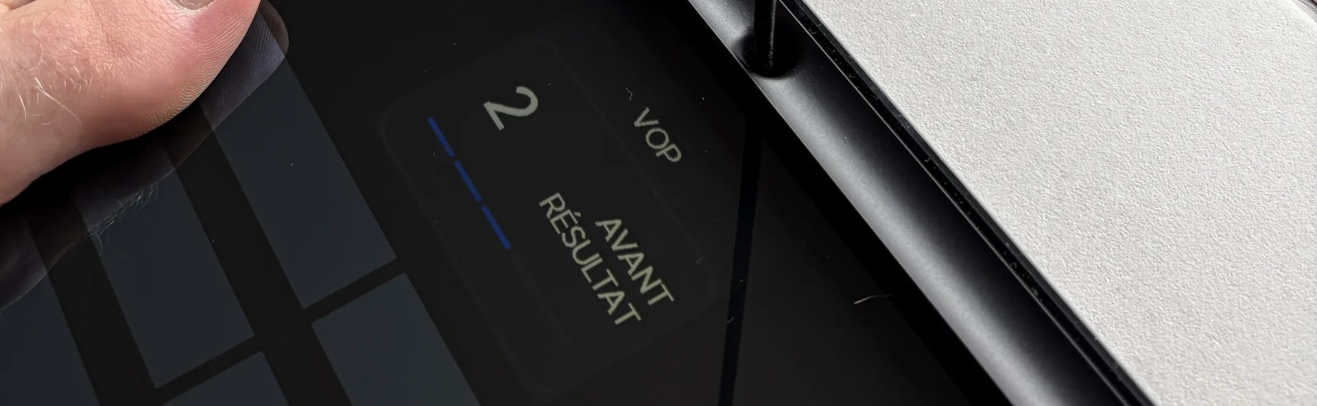 Vitesse d'onde de pouls (VOP) : avant résultat